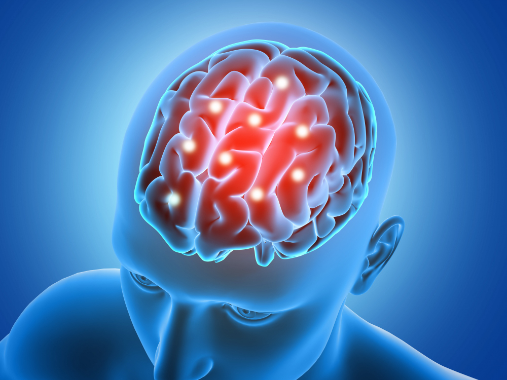 Neurology
